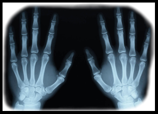 Free Tylenol Pain Relief Free sample of Tylenol Arthritis Pain Relief