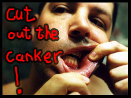 Canker Melts free Sample For Canadians! Canadian Freebies: Cut Out The Canker With CankerMelts!