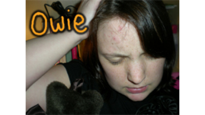 Get Migraines?! Poor you! :( Get Tylenol!?