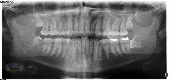 smile-radiography